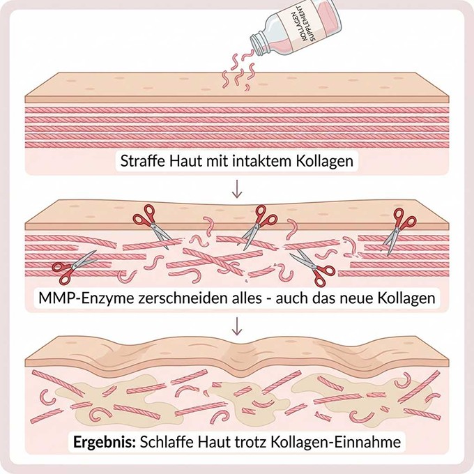 Enzymy MMP niszczące kolagen